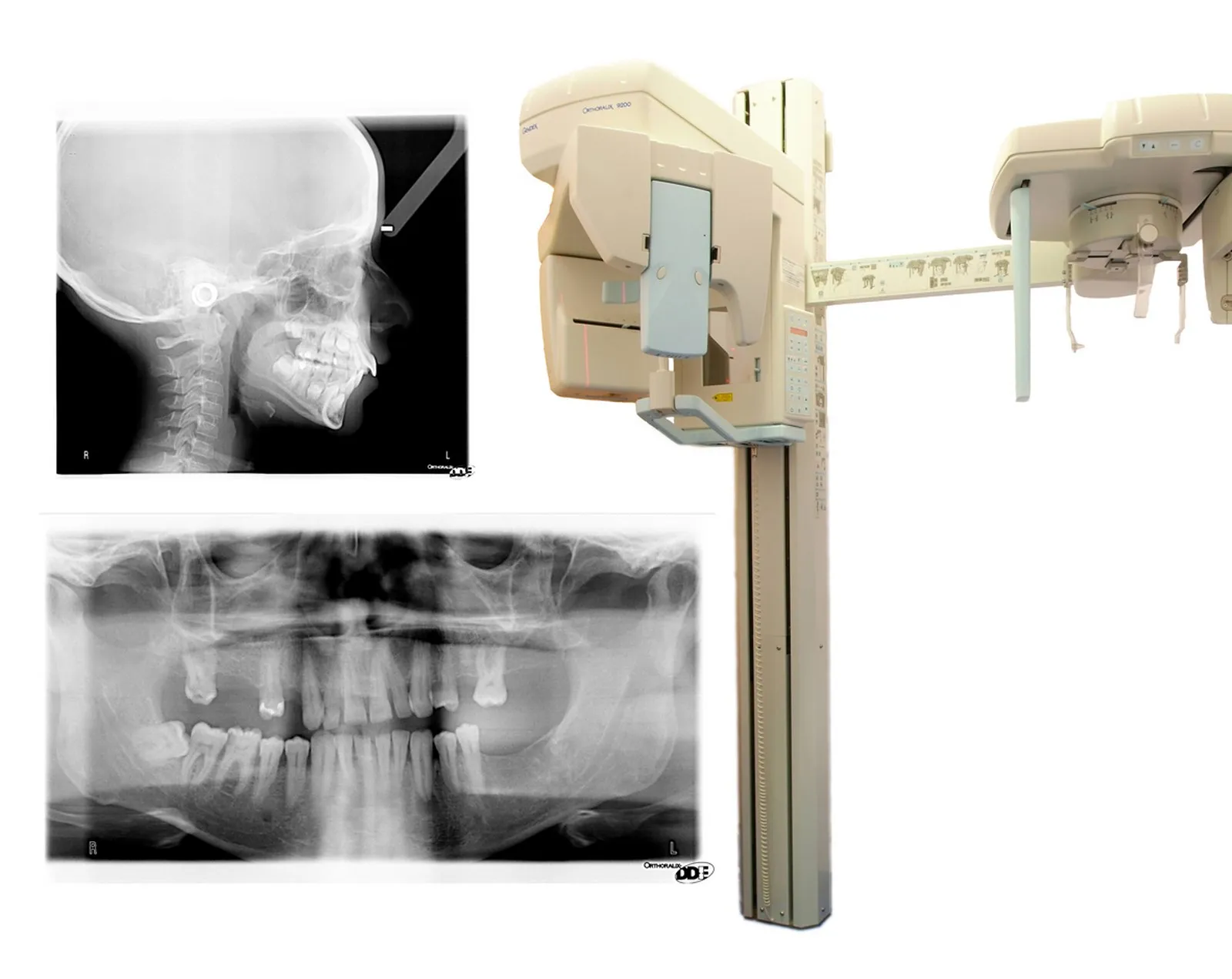 Ortopantomógrafo y radiografías digitales de la Clínica Dental Ignacio Rodríguez Núñez